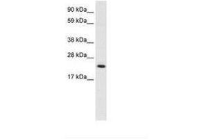 Image no. 2 for anti-High Mobility Group Box 3 (HMGB3) (C-Term) antibody (ABIN203028) (HMGB3 anticorps  (C-Term))