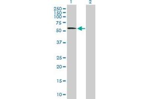 Western Blot analysis of CACNB4 expression in transfected 293T cell line by CACNB4 MaxPab polyclonal antibody.