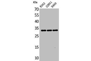 Western Blot analysis of K562 22RV-1 H460 cells using SCP-3 Polyclonal Antibody (SYCP3 anticorps  (Internal Region))