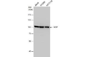 WB Image VCP antibody detects VCP protein by western blot analysis. (VCP anticorps  (C-Term))