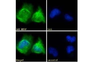ABIN5539690 Immunofluorescence analysis of paraformaldehyde fixed U251 cells, permeabilized with 0. (BDNF anticorps  (Internal Region))