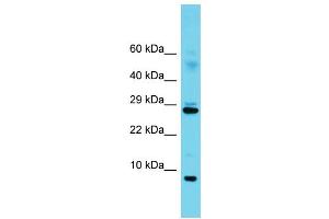 Western Blotting (WB) image for anti-Splicing Factor 3b, Subunit 5, 10kDa (SF3B5) (C-Term) antibody (ABIN2788607) (SF3B5 anticorps  (C-Term))