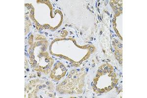 Immunohistochemistry of paraffin-embedded human kidney using ICOSL Antibody (ABIN6130065, ABIN6142131, ABIN6142132 and ABIN6222879) at dilution of 1:100 (40x lens).