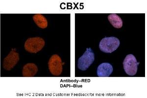 Sample Type :  Human NT-2 cells   Primary Antibody Dilution :  1:500  Secondary Antibody :  Goat anti-rabbit Alexa-Fluor 594  Secondary Antibody Dilution :  1:1000  Color/Signal Descriptions :  CBX5: Red DAPI:Blue  Gene Name :  CBX5  Submitted by :  Dr. (CBX5 anticorps  (Middle Region))