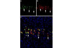 Multiplex staining of nAChR α4 and nAChR β2 in mouse brainImmunohistochemical staining of perfusion-fixed frozen mouse parietal cortex sections using Anti-Nicotinic Acetylcholine Receptor α4 (CHRNA4) (extracellular) Antibody (ABIN7581854), (1:300) and Anti-Nicotinic Acetylcholine Receptor β2 (CHRNB2) (extracellular)-ATTO Fluor-594 Antibody (ABIN7582021), (1:60).