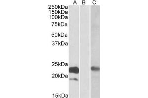 HEK293 lysate (10ug protein in RIPA buffer) overexpressing Human CST8 with C-terminal MYC tag probed with antibody (0. (CST8 anticorps  (Internal Region))