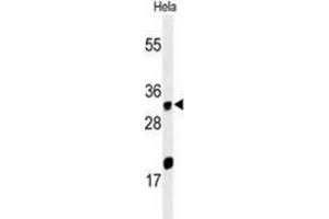 Western blot analysis of ELOVL5 (arrow) in Hela cell line lysates (35ug/lane) using ELOVL5  Antibody (C-term).