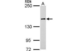 WB Image ROCK1 antibody [N1N2], N-term detects ROCK1 protein by Western blot analysis. (ROCK1 anticorps  (N-Term))