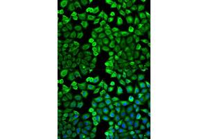 Immunofluorescence analysis of U2OS cells using HNMT antibody.