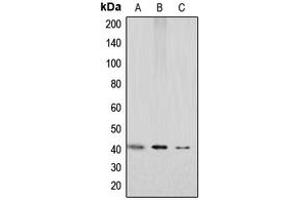Western blot analysis of GPR159 expression in HEK293T (A), mouse kidney (B), rat kidney (C) whole cell lysates. (CXCR7 anticorps  (C-Term))