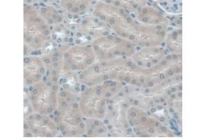 Detection of MCP1 in Mouse Kidney Tissue using Monoclonal Antibody to Monocyte Chemotactic Protein 1 (MCP1) (CCL2 anticorps  (AA 24-96))