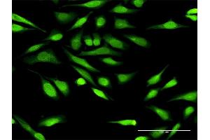 Immunofluorescence of purified MaxPab antibody to IGFBP3 on HeLa cell.