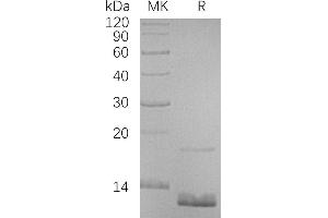 Chemokine (C-C Motif) Ligand 18 (Pulmonary and Activation-Regulated) (CCL18) protein (His tag)