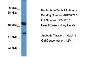 WB Suggested Anti-Centa1  Antibody Titration: 0. (ADAP1 anticorps  (C-Term))