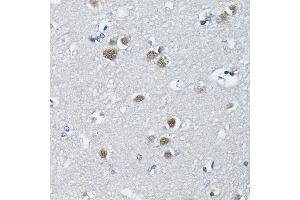 Immunohistochemistry of paraffin-embedded human brain using PTBP2 Rabbit pAb (ABIN6128372, ABIN6146373, ABIN6146374 and ABIN6221684) at dilution of 1:100 (40x lens). (PTBP2 anticorps  (AA 1-280))