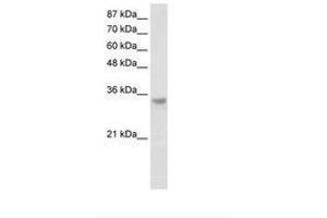 Image no. 2 for anti-Ribonuclease H2, Subunit A (RNASEH2A) (C-Term) antibody (ABIN202188)