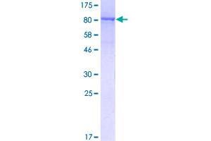 Image no. 1 for Nucleoporin 98kDa (NUP98) (AA 1-606) protein (GST tag) (ABIN1313246)