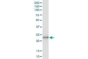 anti-A Kinase (PRKA) Interacting Protein 1 (AKIP1) (AA 1-210) antibody