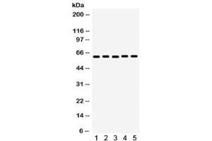 Western blot testing of 1) rat kidney, 2) mouse kidney, 3) human COLO320, 4) human HepG2 and 5) mouse HEPA lysate with MAOA antibody.