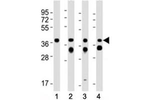 Western blot testing of EpCAM antibody at 1:2000 dilution.