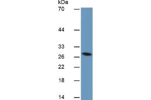 Mouse Detection antibody from the kit in WB with Positive Control:  Sample Human liver Tissue. (IGFBP4 Kit ELISA)