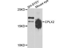 Western blot analysis of extracts of SH-SY5Y and mouse eye cell lines, using CPLX2 antibody. (CPLX2 anticorps)