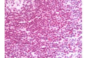 anti-Interferon, gamma-Inducible Protein 16 (IFI16) (AA 630-730) antibody