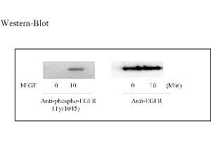 Image no. 4 for Epidermal Growth Factor Receptor (EGFR) ELISA Kit (ABIN1981785) (EGFR Kit ELISA)