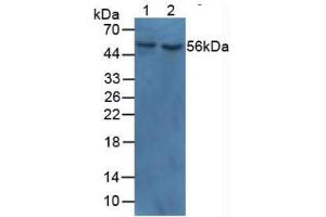 Western blot analysis of (1) Human Lung Tissue and (2) Human Heart Tissue. (MYOC anticorps  (AA 224-471))