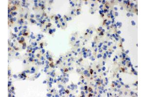 IHC analysis of Lipocalin 2 using anti-Lipocalin 2 antibody .