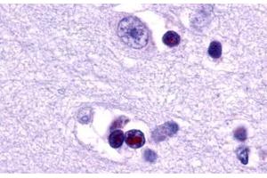 Image no. 1 for anti-Lysophosphatidic Acid Receptor 1 (LPAR1) (Cytoplasmic Domain) antibody (ABIN1048528)