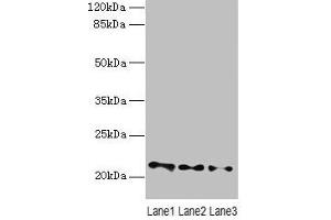 Western blot All lanes: VPS25 antibody at 3 μg/mL Lane 1: Mouse kidney tissue Lane 2: HL60 whole cell lysate Lane 3: THP-1 whole cell lysate Secondary Goat polyclonal to rabbit IgG at 1/10000 dilution Predicted band size: 21 kDa Observed band size: 21 kDa