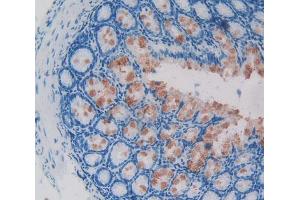 Used in DAB staining on fromalin fixed paraffin- embedded intestine tissue