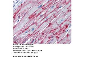 Immunohistochemistry (IHC) image for anti-Polyribonucleotide Nucleotidyltransferase 1 (PNPT1) (Middle Region) antibody (ABIN2776602)
