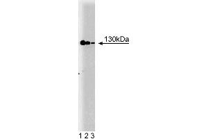 Western blot analysis of iNOS/NOS Type II on a cell lysate from mouse macrophages (RAW 264. (NOS2 anticorps  (AA 961-1144))