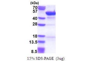 SDS-PAGE (SDS) image for Cytohesin 3 (CYTH3) (AA 1-399) protein (His tag) (ABIN6387422)