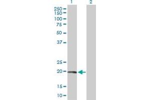Western Blot analysis of CAV1 expression in transfected 293T cell line by CAV1 MaxPab polyclonal antibody. (Caveolin-1 anticorps  (AA 1-178))