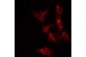 ABIN6267282 staining Hela by IF/ICC. (RAF1 anticorps  (pSer338))