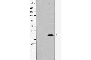 Western blot analysis of extracts of mouse spleen tissue , using ATG5 antibody. (ATG5 anticorps  (C-Term))