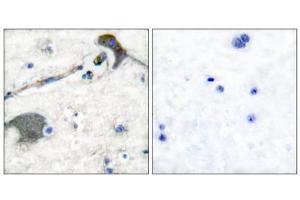 Immunohistochemical analysis of paraffin-embedded human brain tissue, using RASH/RASK/RASN antibody (ABIN5976497). (RASH/RASK/RASN (N-Term) anticorps)