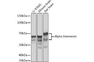 Western blot analysis of extracts of various cell lines, using Alpha Internexin Rabbit mAb (ABIN7268012) at 1:1000 dilution. (INA anticorps)