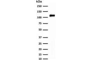 Western blot testing of human kidney lysate with recombinant Cadherin 16 antibody (clone KSCP2-2R). (Cadherin-16 anticorps)