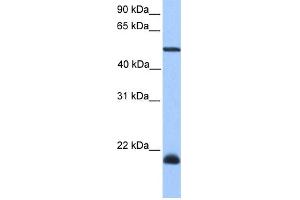 WB Suggested Anti-DYX1C1 Antibody Titration: 0. (DYX1C1 anticorps  (C-Term))