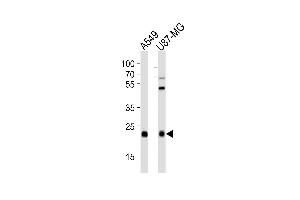 Western blot analysis of lysates from A549,U-87 MG cell line (from left to right),using CATL1 Antibody (heavy chain, Cleaved-Thr288)(ABIN6241621). (CPT1C anticorps  (Cleaved-Thr288))