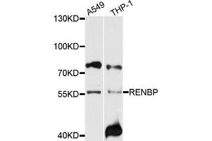 Western blot analysis of extracts of A549 and THP-1 cells, using RENBP antibody. (RENBP anticorps)