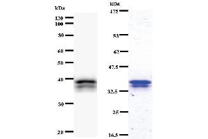 Left: CHD6 staining. (CHD6 anticorps)