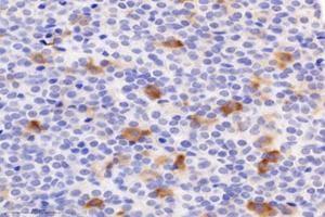 Immunohistochemistry analysis of paraffin-embedded mouse pituitary using,CHST8 (ABIN7073301) at dilution of 1: 3000