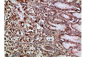 Immunohistochemical analysis of paraffin-embedded human-stomach, antibody was diluted at 1:200