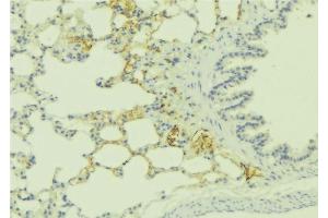 ABIN6275985 at 1/100 staining Human lung tissue by IHC-P.