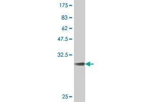 Western Blot detection against Immunogen (31.